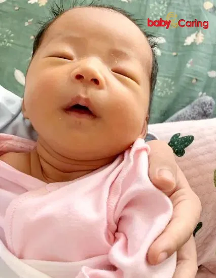 Baby head shape