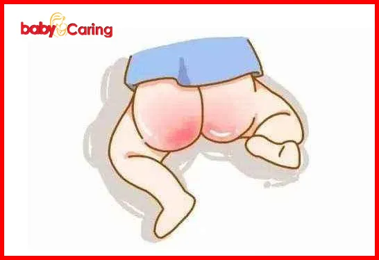 baby’s butt