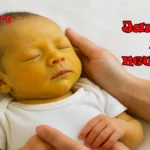 Jaundice in newborn