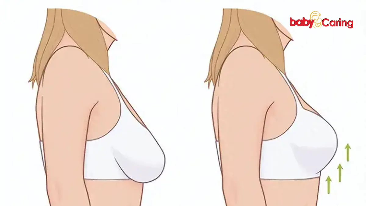 sagging breasts