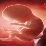 common diseases in newborns