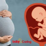 neural tube defects in babies